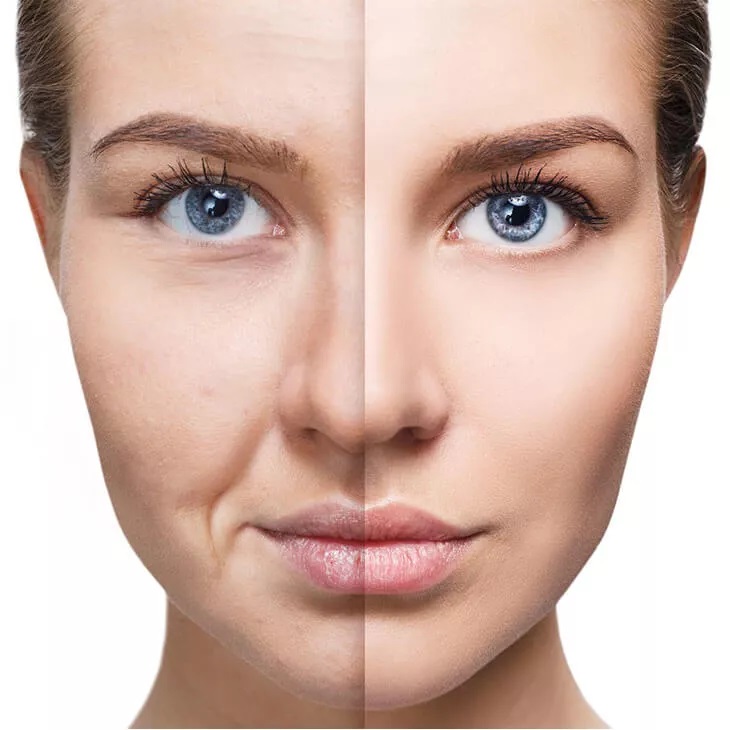 Aesthetics devices — lasers and energy-based systems