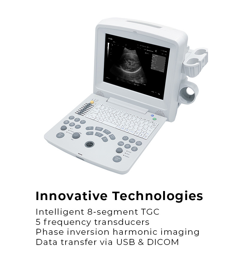 EDAN DUS 60 ultrasound