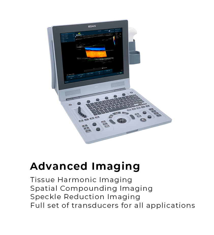 EDAN U60 ultrasound