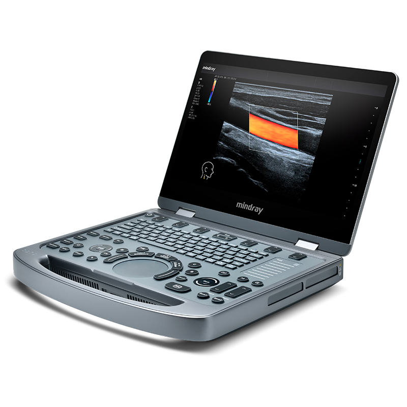 Portable laptop ultrasound