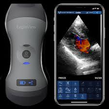 Wireless handheld ultrasound